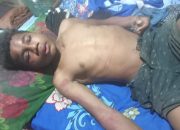 Amnesty Internasional Soroti Kasus Penyiksaan Anak di Keerom