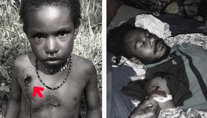 Warga Sipil Tewas di Puncak, Komnas HAM Didesak Bentuk TPF